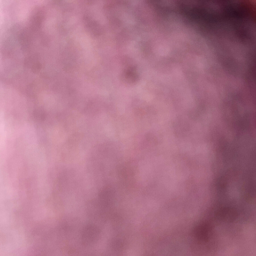 melabella