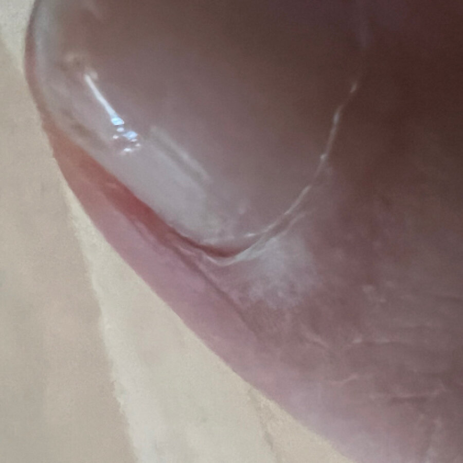 aniefeet